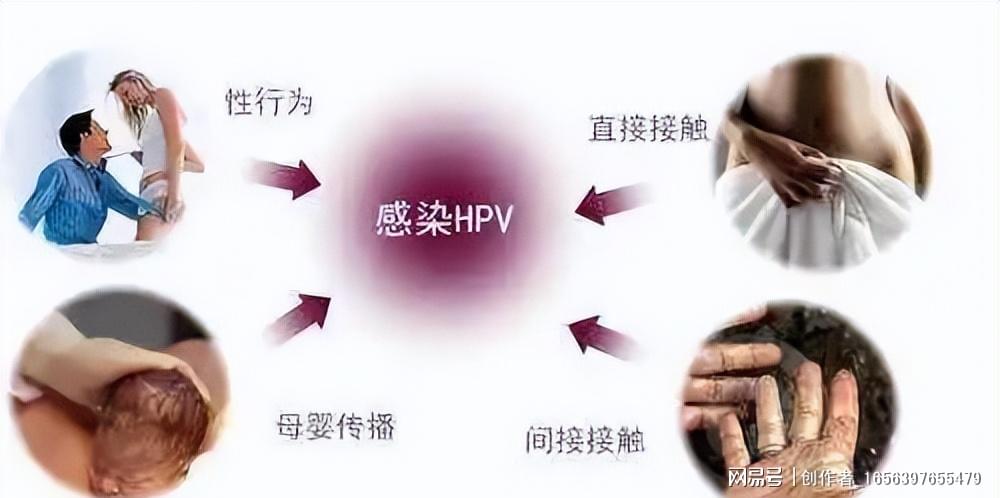 男子因误诊感染HPV耗尽积蓄，医疗误识引发社会深思