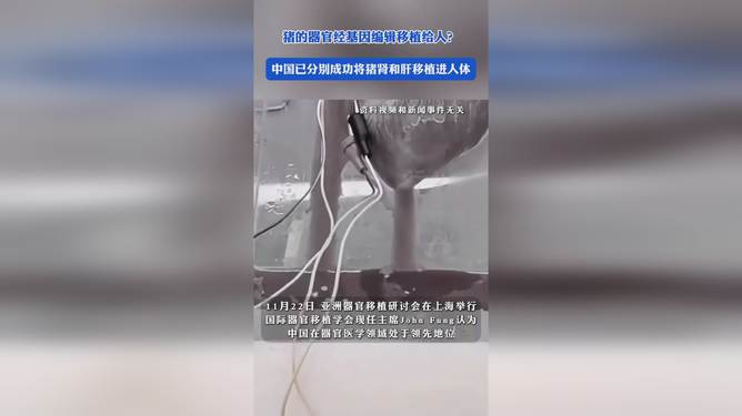 中国实现猪肾与肝移植突破，交汇点的挑战与希望