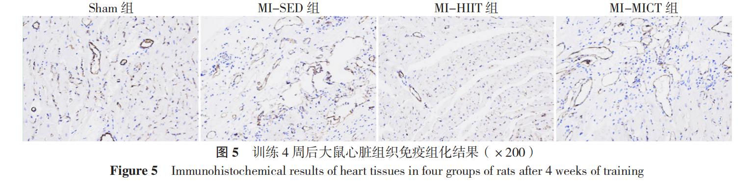 高强度间歇训练对减脂效果的探究