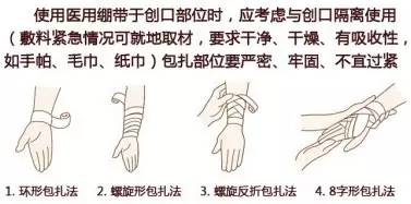 家庭急救创伤包扎技巧与注意事项