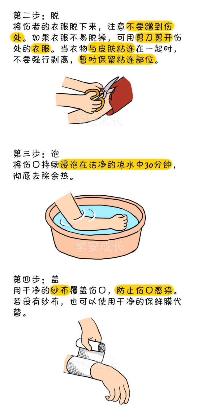 烧烫伤急救五字诀，关键步骤详解与应对策略指南