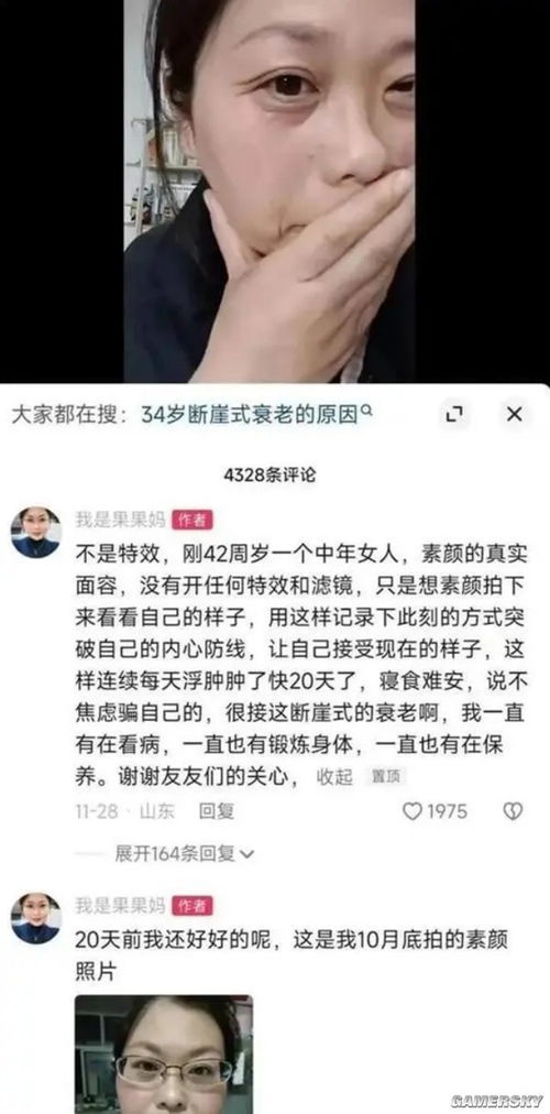 渐冻症女生面临无言挑战与希望并存的故事